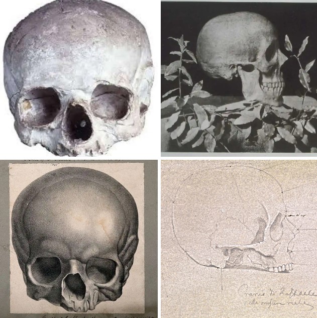 Copy of the cast of Raphael Sanzio's skull by Goethe, Turin; Raphael's exhumed skull in 1833, copy of the skull cast at the Accademia di San Luca, Rome; drawing of Raphael's skull (c. 1833), pencil on paper by Tommaso Minardi (1787–1871), London.Copy of the cast of Raphael Sanzio's skull by Goethe, Turin; Raphael's exhumed skull in 1833, copy of the skull cast at the Accademia di San Luca, Rome; drawing of Raphael's skull (c. 1833), pencil on paper by Tommaso Minardi (1787–1871), London.